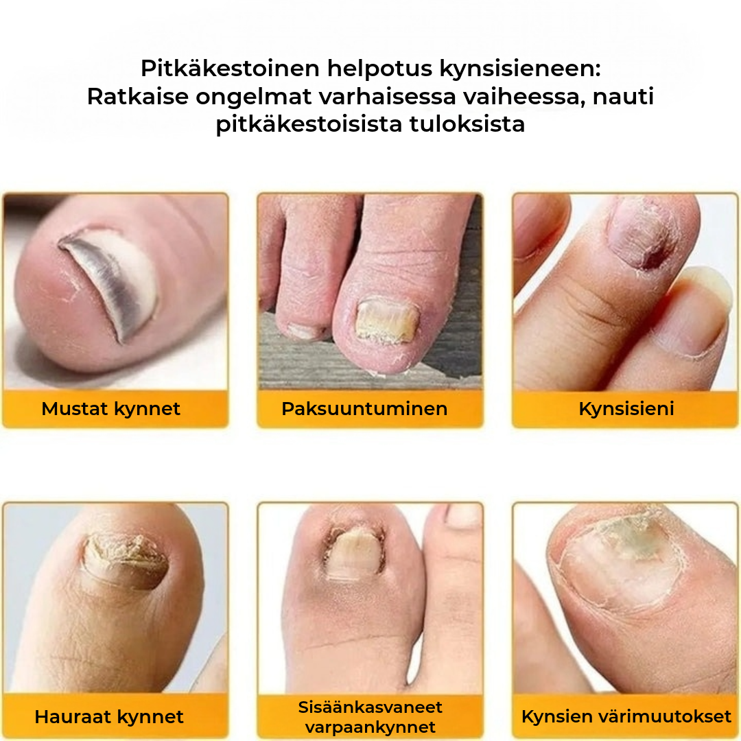 FungalPatch - Antibakteerinen Sieniä Torjuva Laastari ja Kynsienhoitopakkaus