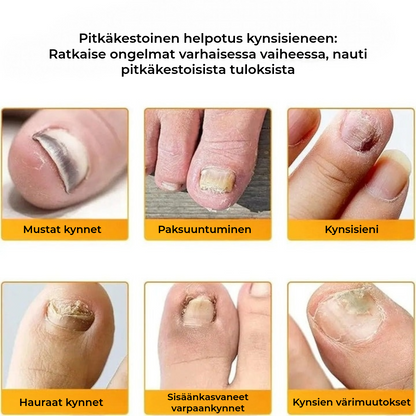 FungalPatch - Antibakteerinen Sieniä Torjuva Laastari ja Kynsienhoitopakkaus