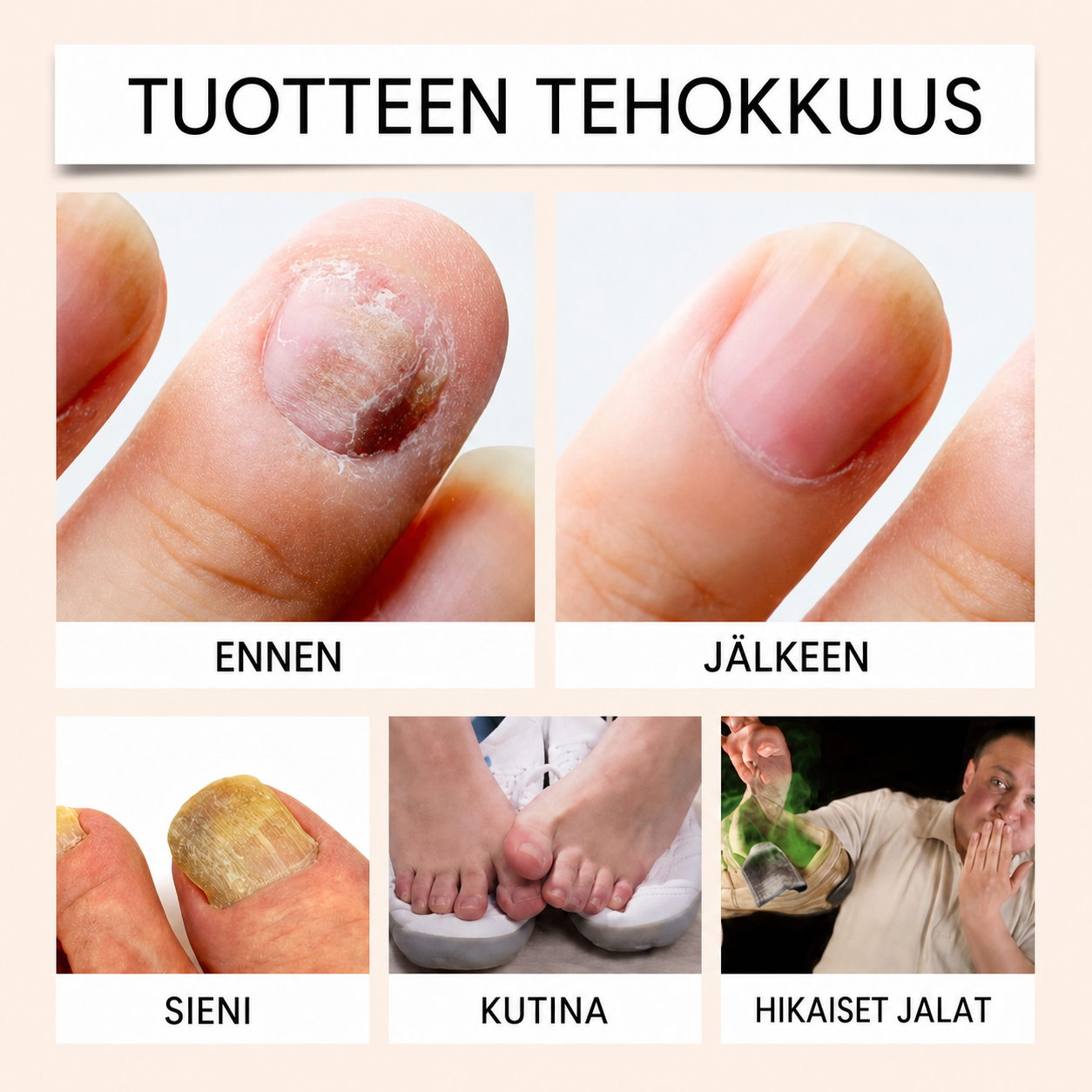 Mehiläismyrkkysuihke kynsisieneen